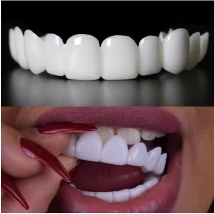 Kiyame™ Snap-On Veneers