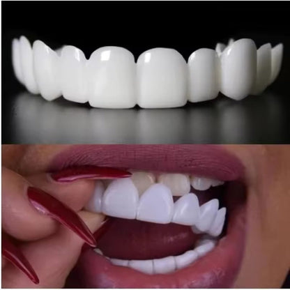 Kiyame™ Snap-On Veneers